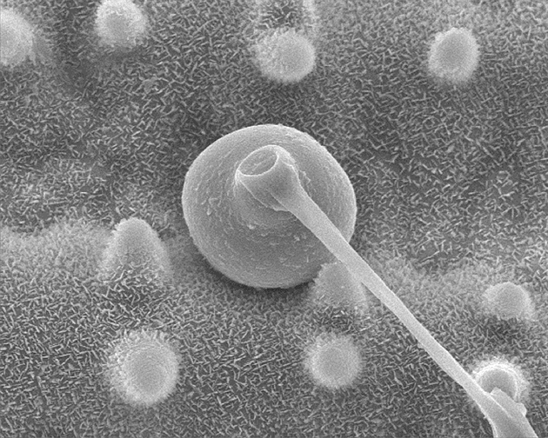 Electron microscope image of an appressorium of Magnaporthe oryzae